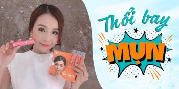 Xịt Lợi Khuẩn Trị Mụn Skin Fresh Review Webtretho Mua Ở Đâu Chính Hãng Giá 2020 [CHI TIẾT A-Z]