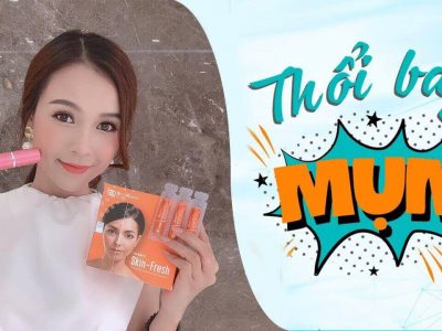 Xịt Lợi Khuẩn Trị Mụn Skin Fresh Review Webtretho Mua Ở Đâu Chính Hãng Giá 2020 [CHI TIẾT A-Z]
