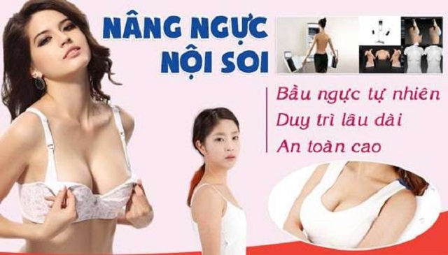 MỘT SỐ C&Aacute;CH TĂNG V&Ograve;NG 1
