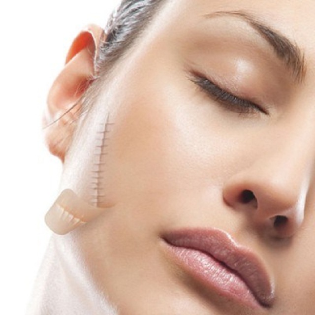 THUỐC TRỊ SẸO SCAR ESTHETIQUE (1)