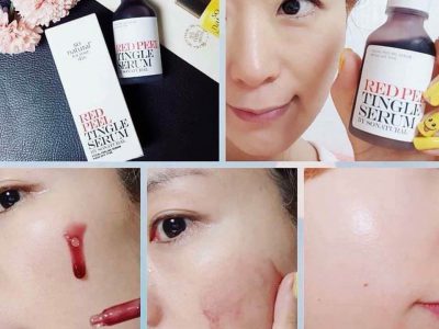 Cách Sử Dụng Red Peel Tingle Serum? Giá Bao Nhiêu? REVIEW Webtretho