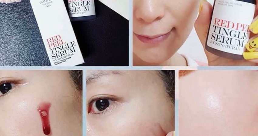 Cách Sử Dụng Red Peel Tingle Serum? Giá Bao Nhiêu? REVIEW Webtretho