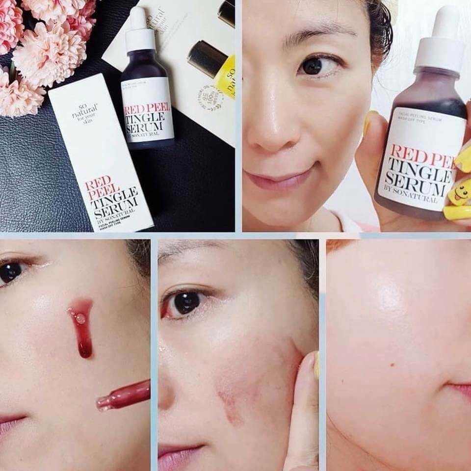 Công dụng Red peel tingle serum