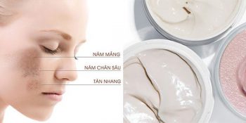 20 Kem Trị Nám Tàn Nhang Hiệu Quả An Toàn Hàng Việt Nam Hàn Quốc Nhật Bản