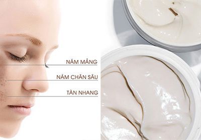 20 Kem Trị Nám Tàn Nhang Hiệu Quả An Toàn Hàng Việt Nam Hàn Quốc Nhật Bản